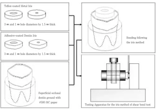 Figure 1.  Schematic  illustration  of  the  experimental  set-up.  The  metal  and  dentin irises  having  a  hole  of  1  ㎜ or  3  ㎜ in  diameter  and  1.5  ㎜ in  thickness  were prepared