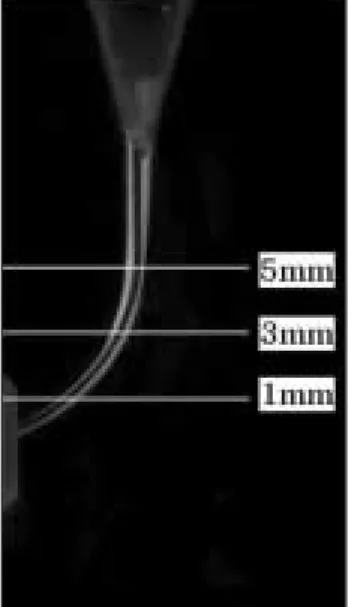 Figure 1.  Determination of the enlarged canal shape at three levels. 