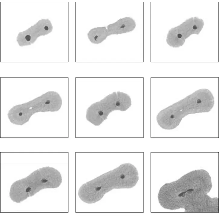 Figure 1. Examples of superimposed images (from the top to the bottom 1, 2, 3, 5 and 8 mm level respectively