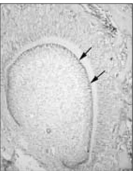 Figure 4.  Expression  of  mRNA  for OD314 in rat mandibular first molar at  postnatal  day  7