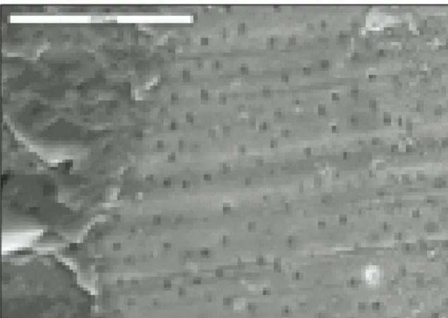 Fig. 10. Post surface of fractured specimen of group 2 (SEM×500 ).