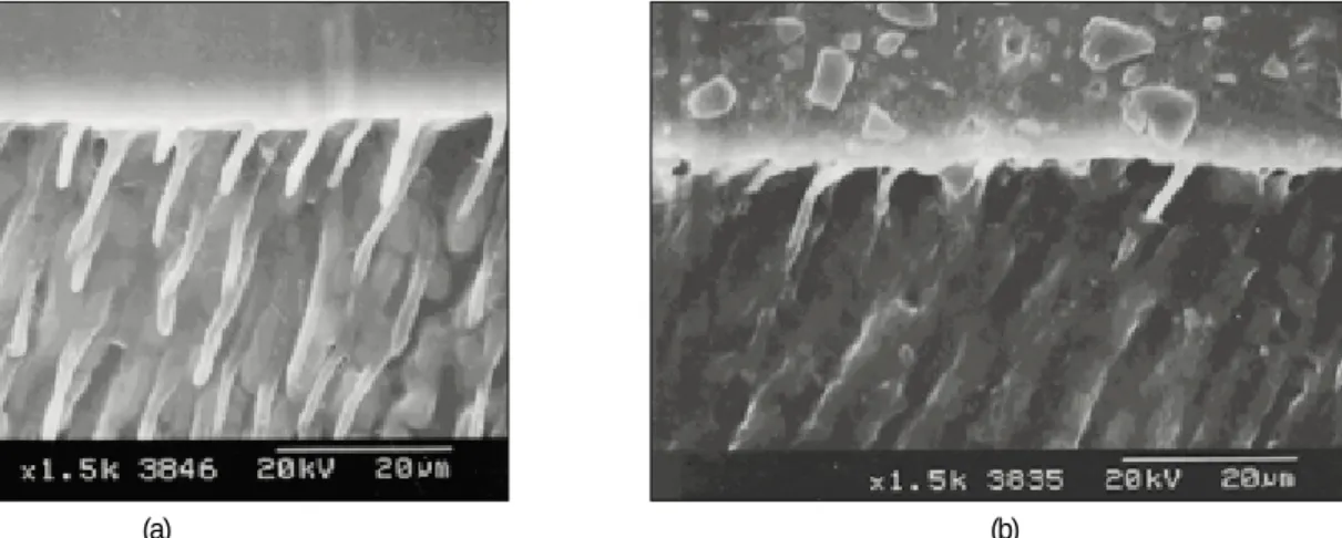 Fig. 6. SEM image of interfaces bonded with Clearfil SE Bond. (a) as the manufacturer’s instruction and bonded with S-0 resin