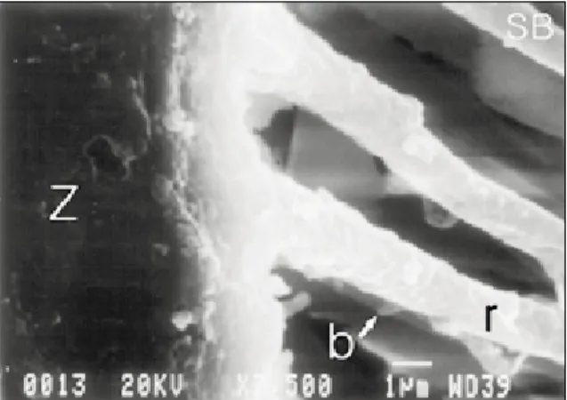 Fig. 3.  Higher magnification of SB group showing resin tags with rough surface (r) and short lateral branches (b)