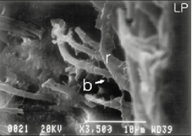 Fig. 9.   Higher magnification of LP group showing resin tags with rough surface (r) and short lateral branches (b)