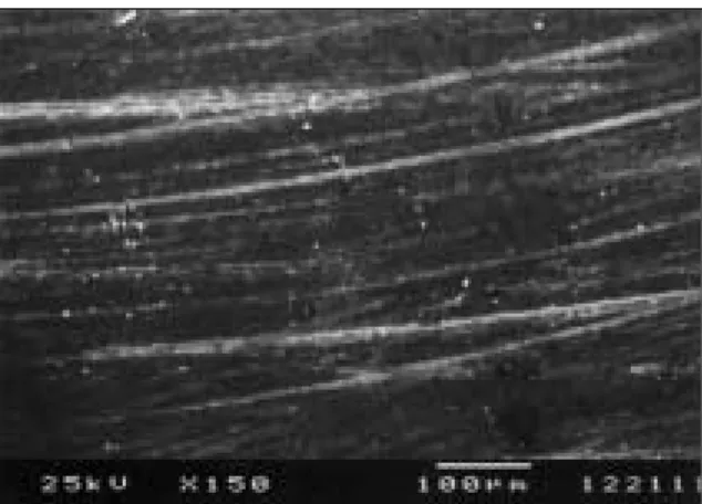 Fig. 8. Filtek  Z250  (PoGo  system,  before  immersion) (×150)
