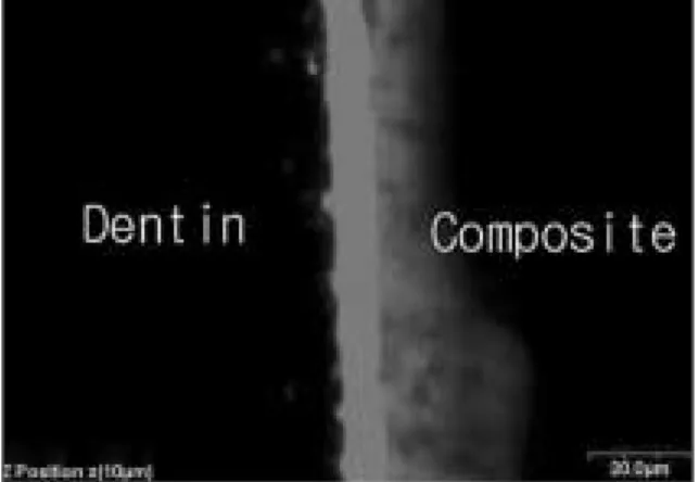 Fig. 10. CLSM image scanned parallel to interface at a depth below 3 ㎛ interval. There were few resin tags like perpendicular group