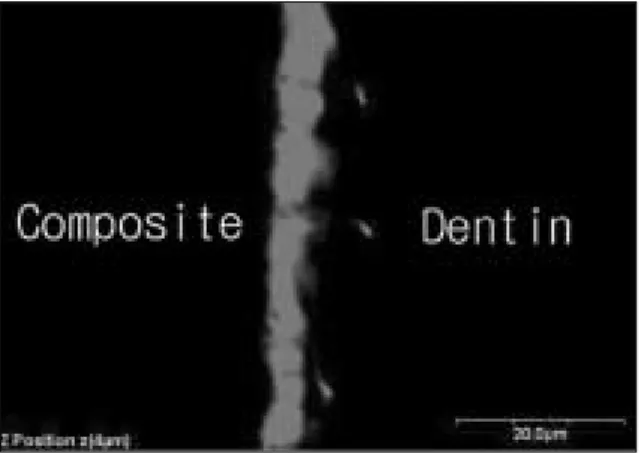 Fig. 11. Overlapped image of fluorescent mode of the interface between CLEARFIL TM SE BOND and dentin.