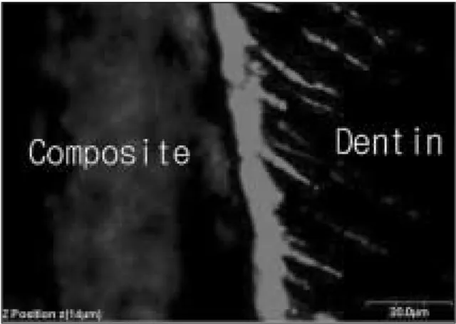 Fig. 16. CLSM image scanned parallel to interface at a depth below 16 ㎛ interval. The white arrow indicate resin tags