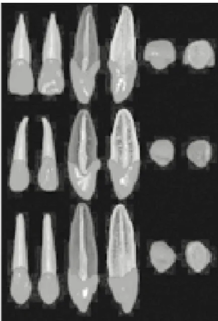 Fig. 2. Three-dimensionally  reconstructed  upper premolars. Upper: 1st premolar, Lower: 2nd premolar.
