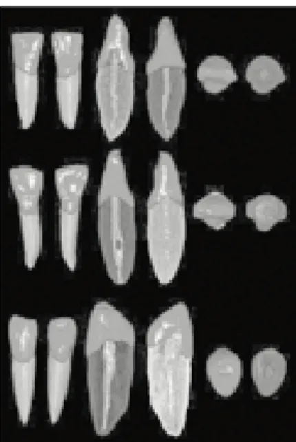 Fig. 3은 상악 대구치들로 위로부터 제 1 대구치, 제 2 대 구치 순으로 나열하였으며,  좌로부터 순면,  설면,  근심면, 원심면, 절단면, 근첨면에서 본 모습 순으로 배치하였다