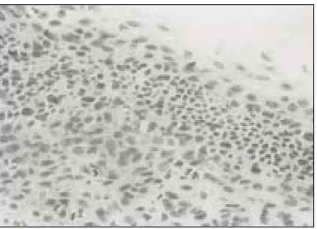 Fig. 11. The pulp tissue in the P.E. group at 5th day after irritation (H&amp;E stain ×400).