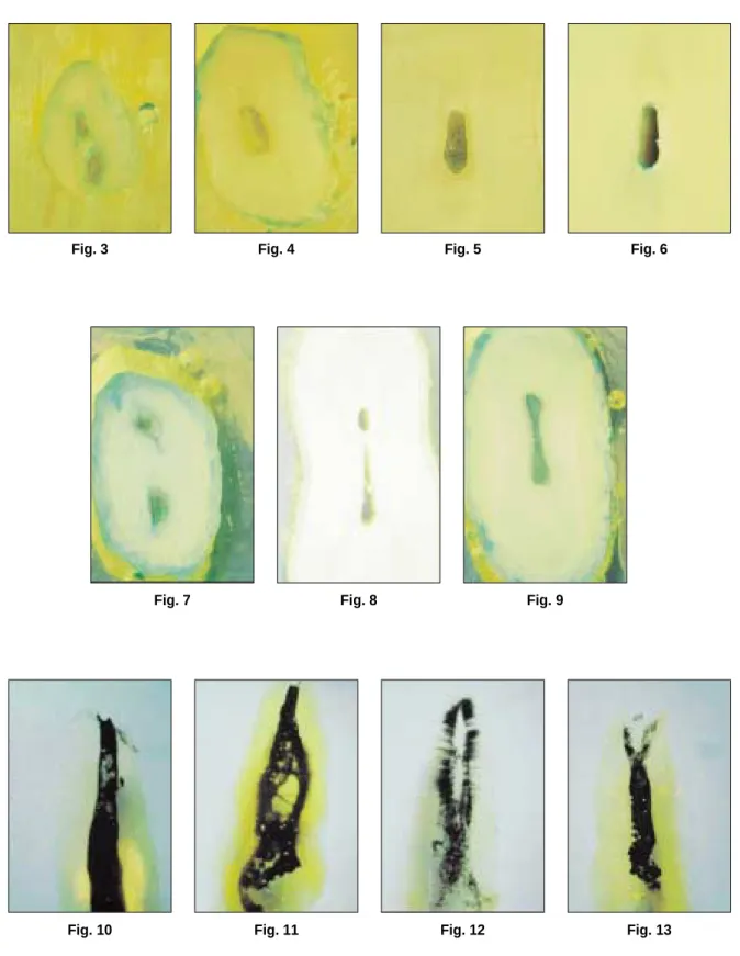 Fig. 3 Fig. 4 Fig. 5