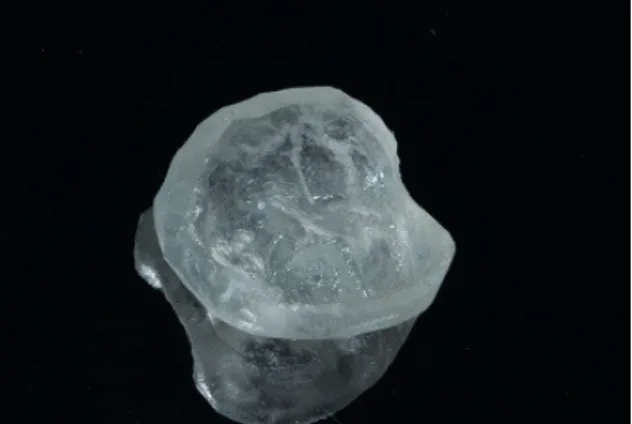 Figure 2. Matrix resin to be placed in occlusal tooth face.