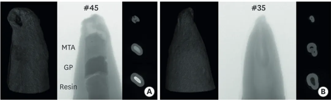 Figure 2. Reconstructed 3D images of teeth #45 and #35 obtained by micro-computed tomography