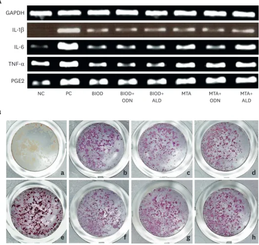 Figure 2. (A) The effects of calcium silicate-based cement with odanacatib (ODN) and alendronate (ALD) on mRNA  expression for interleukin (IL)-1β, IL-6, tumor necrosis factor (TNF)-α, and prostaglandin E2 (PGE2)