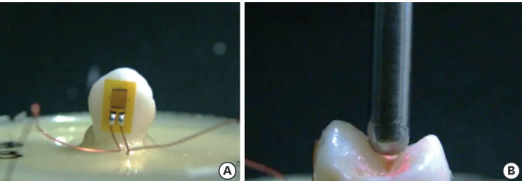 Figure 2. Cusp deflection analysis. (A) Strain gauges were bonded to each tooth to evaluate the cusp deflection; 