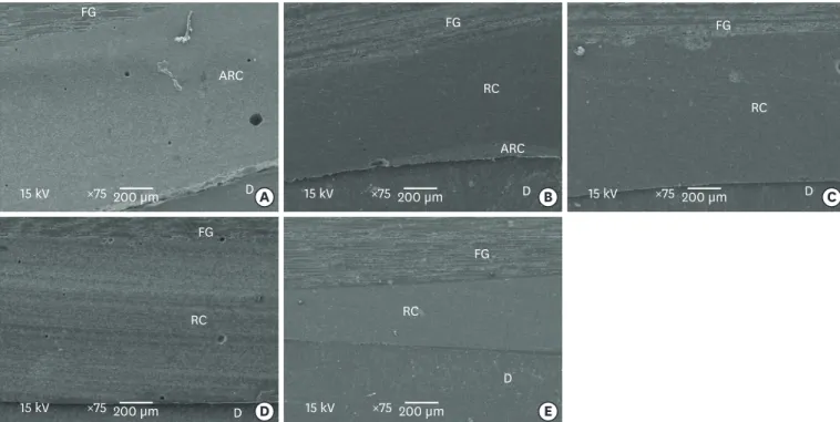 Figure 2. Scanning electron microscopic images of the adhesive interface present in each of the 5 groups (A, G1; B, G2; C, G3; D, G4; E, G5)