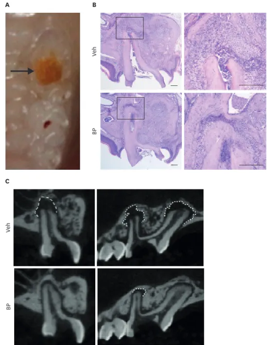 Figure 1. Bisphosphonates (BPs) prevent bone resorption at the apex of the pulp-exposed tooth despite the presence of inflammatory cells