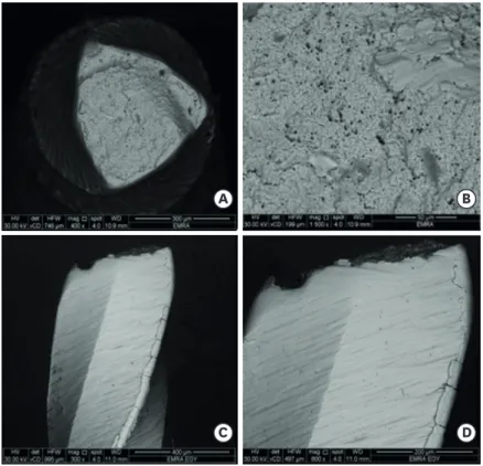 Figure 2. (A) A scanning electron micrograph of the fractured surface (cross-sectional view) of a representative  sample of the M-Pro group after cyclic fatigue testing using low magnification (×400) shows the general features  of cyclic fatigue failure su