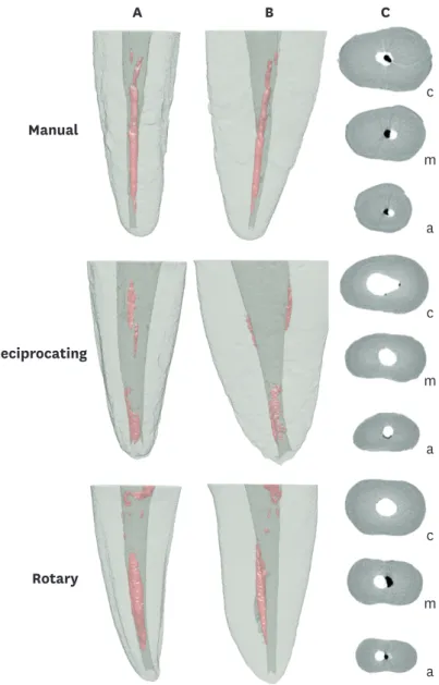 Figure 1. Reconstructed 3-dimensional micro-computed tomographic (micro-CT) images of a given specimen of  each group showing the presence of remaining root canal fillings in (A) bucco-lingual and (B) mesio-distal views