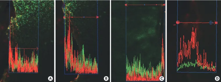 Figure 3. Confocal laser scanning microscopy (CLSM) images after root canal preparation and disinfection in the (A) XP-endo Shaper combined with 