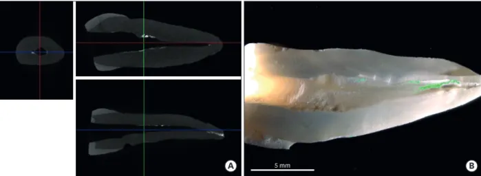 Figure 1. (A) Representative micro-computed tomographic (μ-CT) images show the radiopaque remnants of each material
