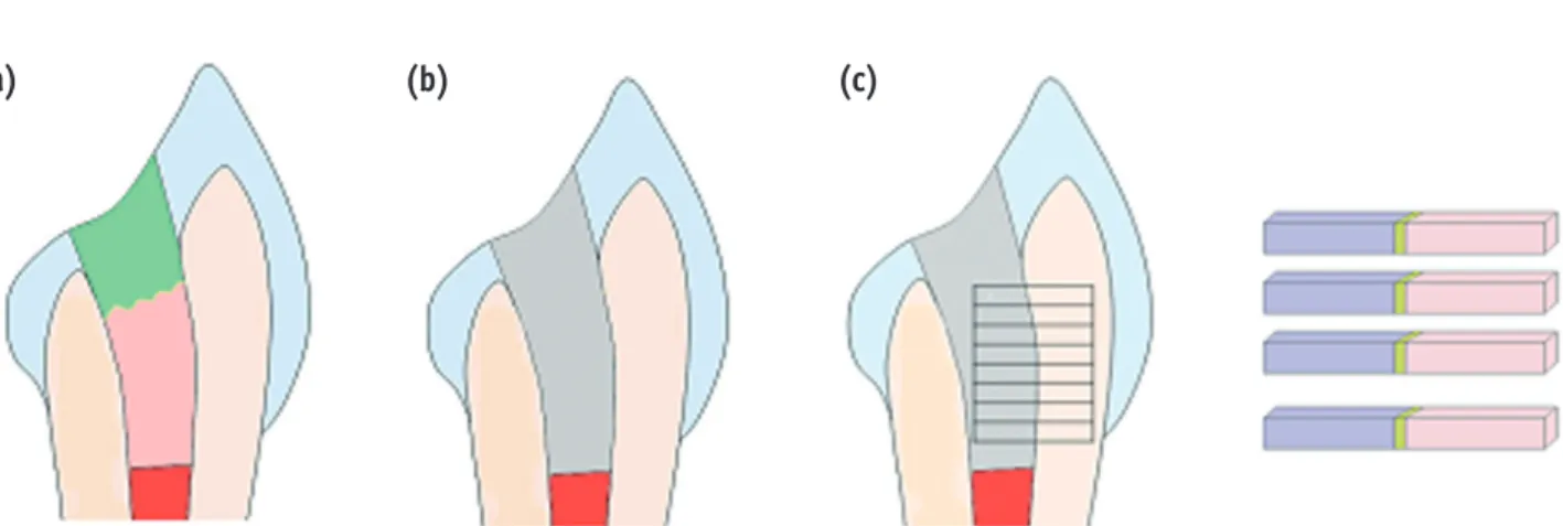 Figure 1. Specimen preparation for microtensile bond strength test. (a) Access cavity preperation and non-vital 