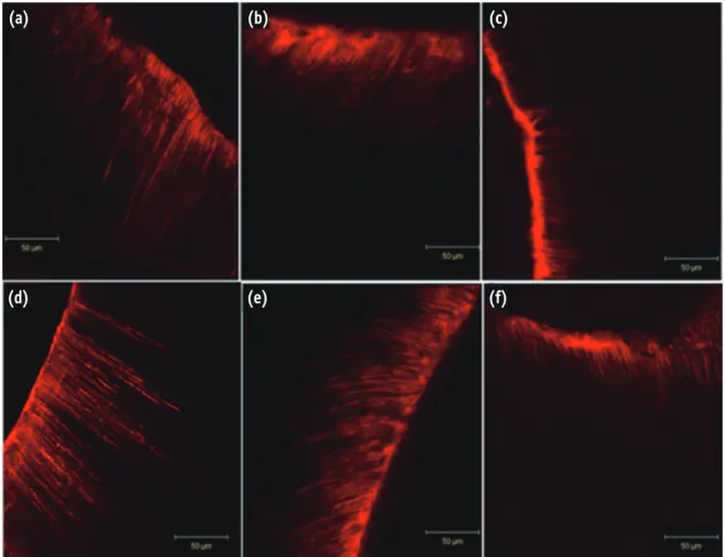 Table 1. Comparison of penetration depth (µm) of 2% chlorhexidine into root dentinal tubules