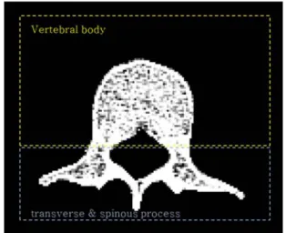 Fig.  4.  A  concept  of  the  volume  construction  and  the  multi-planar  reconstruction  from  two-dimensional  CT  images