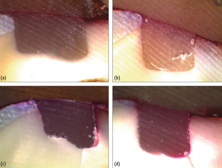 Figure 1. Representative microscopic images showing the scores of microleakage, taken under a stereomicroscope (at a  x40 magnification)