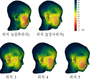 Fig.  2.  SAR  distribution  in  model  Billie  for  exposure  from  a  bar  type  of  mobile  phone.