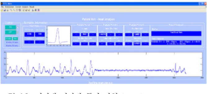 그림 12.  서버에 전달된 특이 파형(       ) Fig. 12.  Unusual  waveforms  at  server      