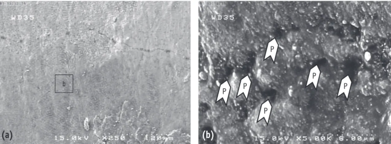 Figure 1. SEM views of the fractured surface in group 2, showing porosities in the resin layer on the  bonded enamel surface (P, porosity)