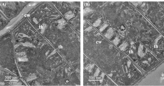 Fig. 4. Transmission electron micrographs of Aerosakkonema funiforme strain FBCC-A397