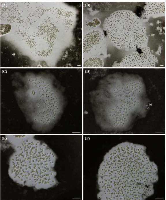 Fig. 1. Microscopic photographs of Microcystis protocystis (MP) collected from Korea freshwaters (mucilage stained by India ink)