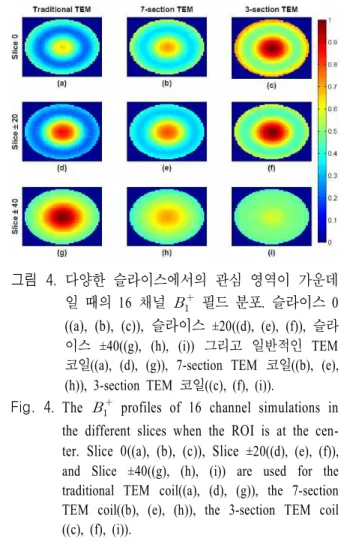 그림  2.  7  T  MRI에서 사용되는 세 가지의 다른 형태 를 가진 각각의 TEM  코일 소자