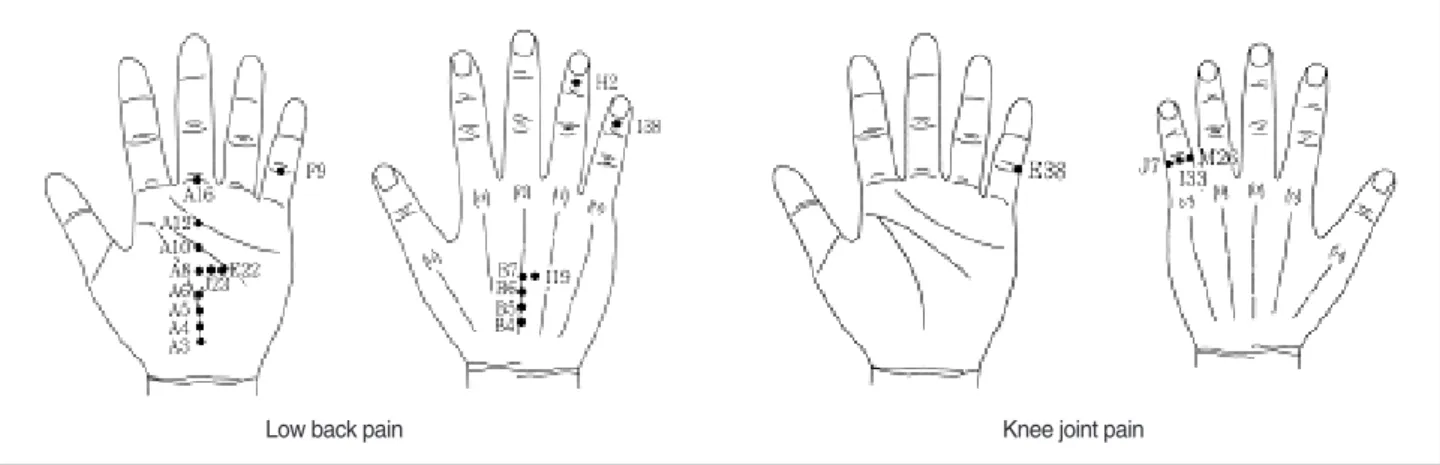 Figure 2. Corresponding points on hands for lowback pain and knee joint pain.