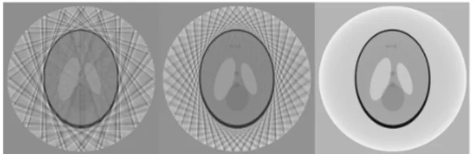 Fig.  1.    The  tomographic  images  reconstructed  from  20(left),  45(middle),  and  360(right)  views,  respectively