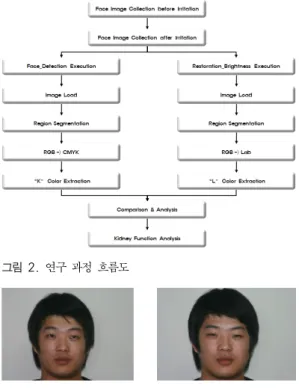 그림 2. 연구 과정 흐름도 그림 3. 이혈(耳穴)을 자극하기 전과 후의 영상穴)이라고 부르며 이를 토대로 한 이침 요법은 귀에 침을 놓아 인체 각부의 질병을 치료하는 침술 요법을 말한다[6-7]