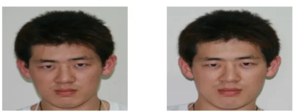 그림 10. M-14의 이혈 자극하기 전과 후의 영상 그림 11.  Face_Detection을 통한 M-14의 지각 영역 K값 추출 그림  12.  Restoration_Brightness을  통한  M-14의  지각  영역  L값 추출 피실험자 CMYK  체계에서의 K값 편차신장  이혈  자극  전 신장  이혈 자극  후 M-01 12 9 -3 M-02 5 4 -1 M-03 21 13 -8 M-04 17 5 -12 M-05 15 6 -9 M-06 14