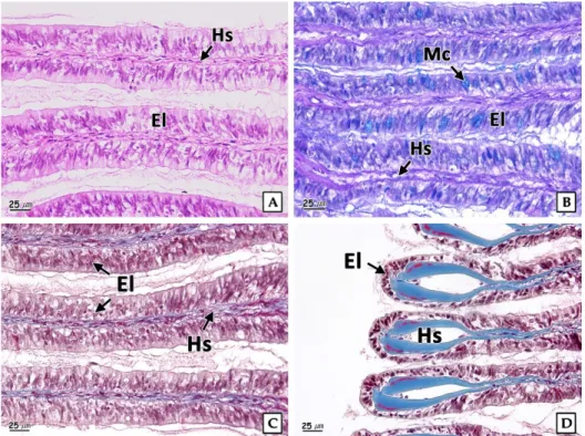 Fig.  5.  Histological  changes  of  gill  in  the  abalone  Haliotis discus hannai exposed  to  nickel  chloride for 4 weeks