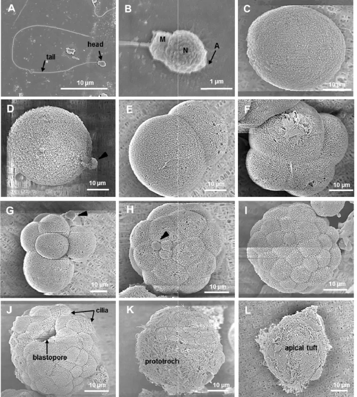 Fig. 3. SEM (Scanning Electron Microscopy) ultrastructure of Saccostrea kegaki in different development stages