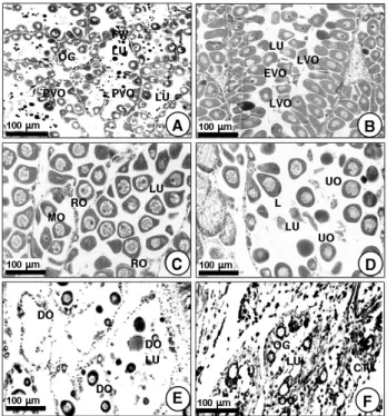 Fig. 6. Gonadal phases of the testis in male Coecella  chinensis observed under the light    microscopy
