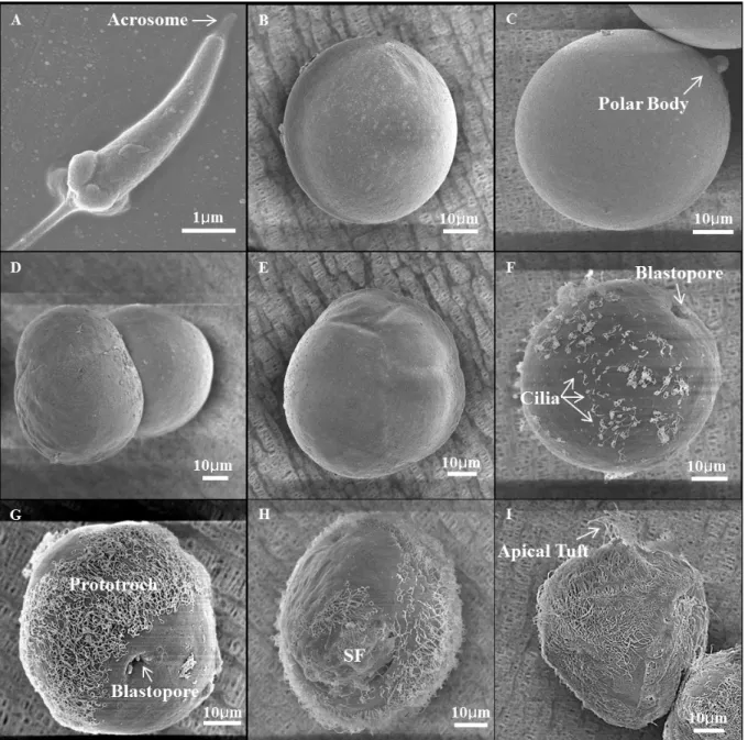 Fig. 5. SEM (Scanning Electronic Microscope) ultrastructure of Ruditapes philippinarumlarvae in different development  stages