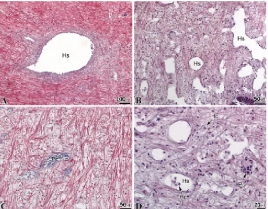 Fig. 5. Histopathological changes of the muscle of abalone, Haliotis discus hannai.   exposed  diluted sea water