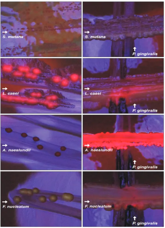 Fig. 1. The blue-light image of S. mutans,  L. casei, A. naeslundii, F. nucleatum  culti-vated on TSA blood media