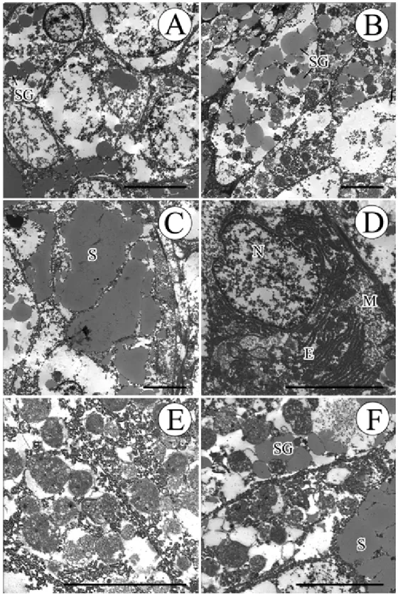 Fig 1. Transmission electron micrographs of the digestive gland of Oyster (Euiwang-ri, March, 2008)