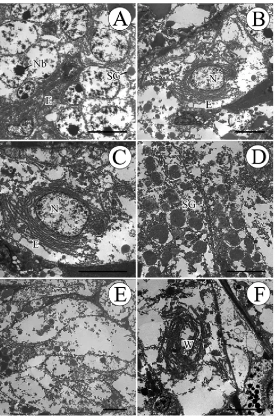 Fig 3. Transmission electron micrographs of the digestive gland of Oyster (Jonghyeon, May,  2008)