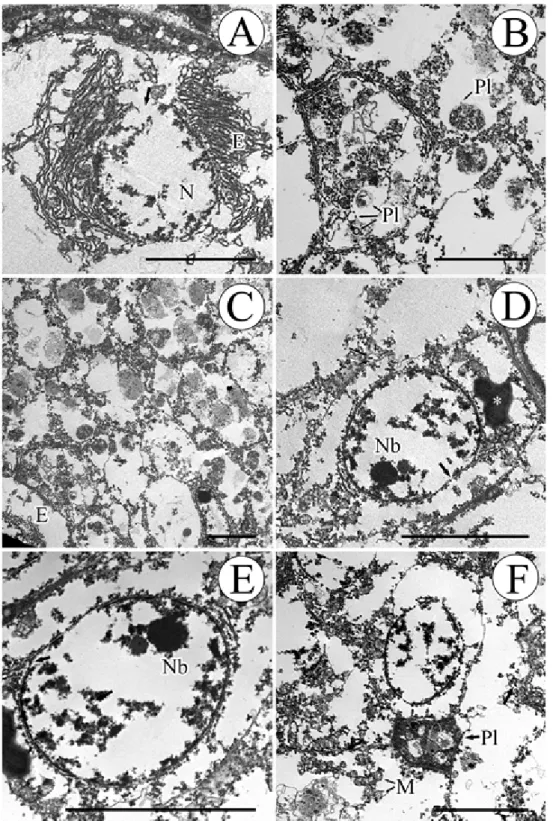 Fig 4. Transmission electron micrographs of the digestive gland of Oyster (Sindu-ri, May, 2008)