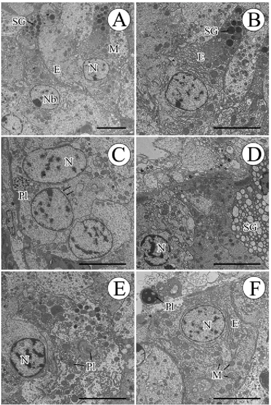 Fig 5. Transmission electron micrographs of the digestive gland of Oyster (Jonghyeon, August, 2008)